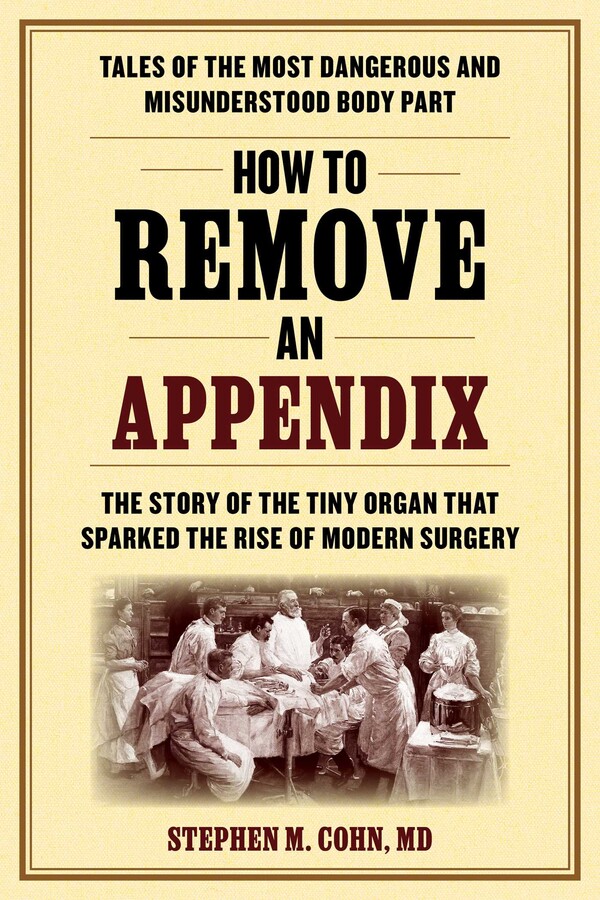 How to Remove an Appendix