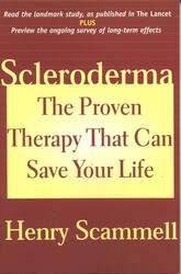 Scleroderma