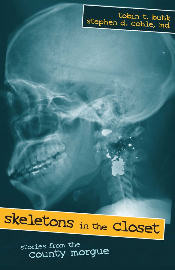 Skeletons in the Closet