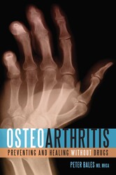 Osteoarthritis Osteoarthritis