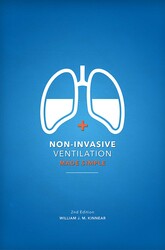 Non-Invasive Ventilation Made Simple 2nd Edition