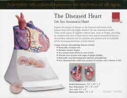 Life Size Diseased Heart Model Life Size Diseased Heart Model