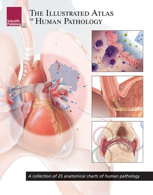 The Illustrated Atlas of Human Pathology The Illustrated Atlas of Human Pathology