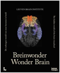 Wonder Brain Wonder Brain