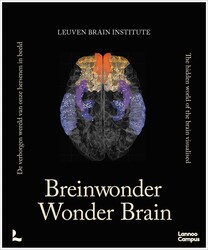 Wonder Brain