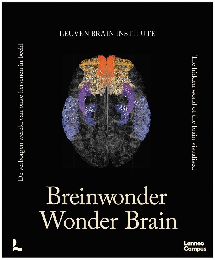 Wonder Brain