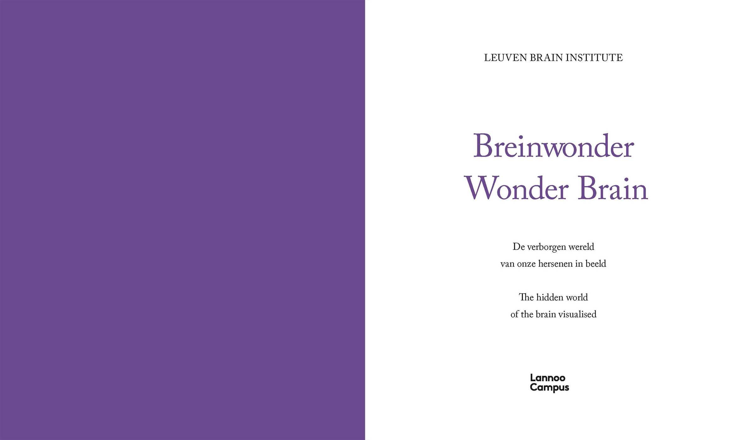 Wonder Brain