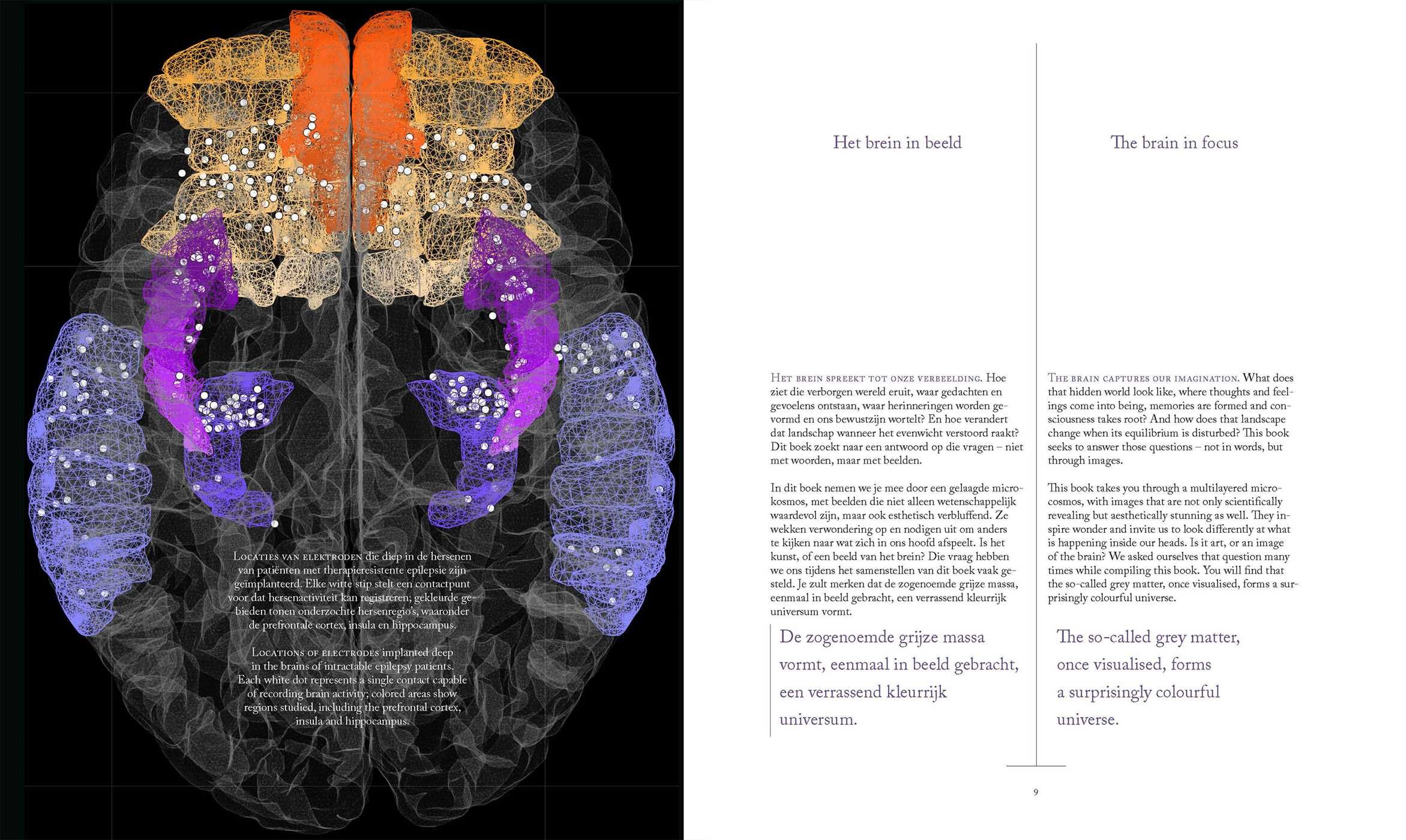 Wonder Brain